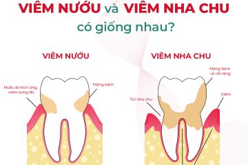 Viêm nướu và viêm nha chu có giống nhau hay không?