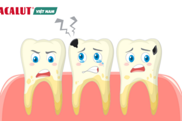 Sâu răng là gì? Bí quyết điều trị sâu răng hiệu quả