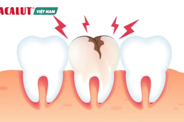 Sâu răng uống thuốc gì? Các loại thuốc được tin dùng