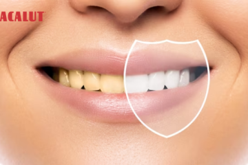Đánh bay vết ố vàng với kem đánh răng làm trắng răng hiệu quả